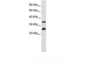 Image no. 1 for anti-Metal Response Element Binding Transcription Factor 2 (MTF2) (AA 26-75) antibody (ABIN6736029) (MTF2 anticorps  (AA 26-75))