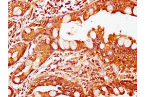 IHC image of ABIN7174242 diluted at 1:200 and staining in paraffin-embedded human small intestine tissue performed on a Leica BondTM system.