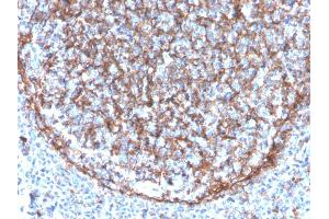 Formalin-fixed, paraffin-embedded human tonsil stained with CD11b Monospecific Mouse Monoclonal Antibody (ITGAM/3340).