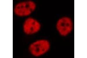 ABIN6268842 staining HeLa cells by IF/ICC. (MGMT anticorps  (N-Term))