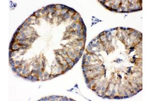 IHC testing of mouse testis with BAG2 antibody.