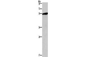 Western Blotting (WB) image for anti-5-Hydroxytryptamine (serotonin) Receptor 2C (HTR2C) antibody (ABIN2432626) (HTR2C anticorps)