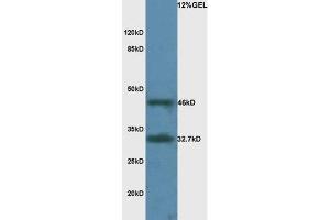Mouse brain lysate probed with Rabbit Anti-LAMR1 Polyclonal Antibody, Unconjugated  at 1:3000 for 90 min at 37˚C. (RPSA/Laminin Receptor anticorps  (AA 101-200))