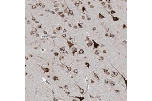 Immunohistochemical staining of human cerebral cortex with C2orf30 polyclonal antibody  shows cytoplasmic positivity in neuronal cells. (C2orf30 anticorps)
