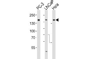 Western blot analysis of lysates from PC-3, LNCaP, Hela cell line (from left to right), using Tuberin (TSC2) Antibody (ABIN390324 and ABIN2840755). (Tuberin anticorps  (AA 1776-1805))