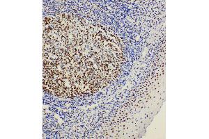 Anti-BOB1 antibody, IHC(P) IHC(P): Rat Tonsil Tissue (POU2AF1 anticorps  (C-Term))