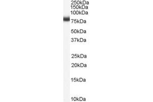 Western Blotting (WB) image for anti-Numb Homolog (NUMB) (C-Term) antibody (ABIN2465260) (NUMB anticorps  (C-Term))