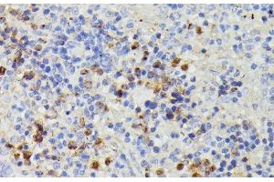 Immunohistochemistry of paraffin-embedded Rat spleen using DUT Polyclonal Antibody at dilution of 1:100 (40x lens).