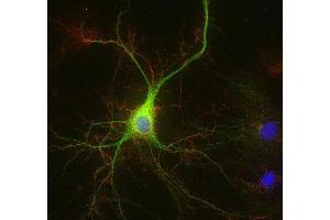 Indirect immunostaining of methanol fixed rat hippocampus neurons with anti-ADAM 22 (dilution 1 : 500; red) and mouse anti-MAP 2 (, dilution 1 : 1000; green).
