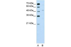 ZNF19 antibody used at 0. (ZNF19 anticorps  (N-Term))