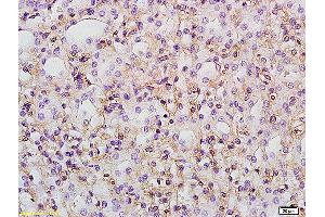 Formalin-fixed and paraffin embedded rat kidney labeled with Anti PTGER1/EP1 Polyclonal Antibody, Unconjugated at 1:200 followed by conjugation to the secondary antibody and DAB staining