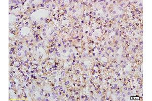 Formalin-fixed and paraffin embedded rat kidney labeled with Anti PTGER1/EP1 Polyclonal Antibody, Unconjugated at 1:200 followed by conjugation to the secondary antibody and DAB staining (PTGER1 anticorps  (AA 61-160))