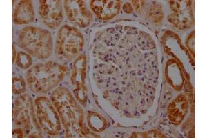 IHC image of ABIN7127803 diluted at 1:100 and staining in paraffin-embedded human kidney tissue performed on a Leica BondTM system. (Recombinant SDHB anticorps)