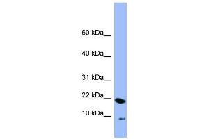WB Suggested Anti-PIN4 Antibody Titration: 0. (PIN4 anticorps  (N-Term))