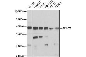 Western blot analysis of extracts of various cell lines, using PRMT5 antibody (ABIN3022065, ABIN3022066, ABIN3022067 and ABIN6218592) at 1:1000 dilution.