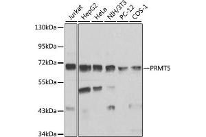 Western blot analysis of extracts of various cell lines, using PRMT5 antibody (ABIN3022065, ABIN3022066, ABIN3022067 and ABIN6218592) at 1:1000 dilution. (PRMT5 anticorps  (AA 40-140))