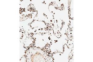 Immunohistochemical analysis of paraffin-embedded human lung tissue using B performed on the Leica® BOND RXm. (STRA8 anticorps  (C-Term))