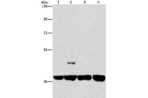 Western Blot analysis of 293T and 231 cell, U937 and Raji cell using SERPINA9 Polyclonal Antibody at dilution of 1:350 (SERPINA9 anticorps)