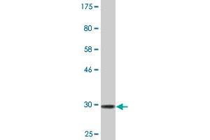 Western Blot detection against Immunogen (31.