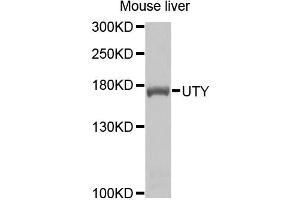 Western blot analysis of extracts of mouse liver cells, using UTY antibody. (UTY anticorps)