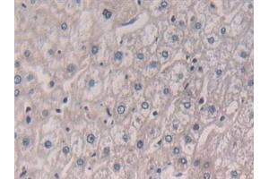 Detection of IL5 in Human Liver Tissue using Polyclonal Antibody to Interleukin 5 (IL5)