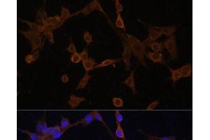 Immunofluorescence analysis of NIH/3T3 cells using BID Polyclonal Antibody at dilution of 1:100. (BID anticorps)