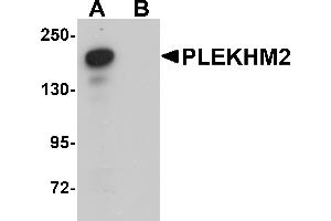 Western Blotting (WB) image for anti-Pleckstrin Homology Domain Containing, Family M (With RUN Domain) Member 2 (PLEKHM2) (C-Term) antibody (ABIN1030591) (PLEKHM2 anticorps  (C-Term))