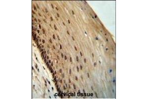 SPDYE3 antibody (Center) (ABIN654315 and ABIN2844097) immunohistochemistry analysis in formalin fixed and paraffin embedded human cervical tissue followed by peroxidase conjugation of the secondary antibody and DAB staining. (SPDYE3 anticorps  (AA 455-483))