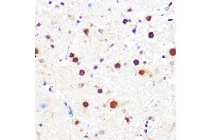 Immunohistochemistry of paraffin-embedded mouse spinal cord using KLF4 Rabbit mAb (ABIN7268157) at dilution of 1:100 (40x lens).
