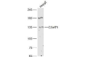 HepG2 lysates probed with C2orf71 Polyclonal Antibody, Unconjugated  at 1:300 dilution and 4˚C overnight incubation.