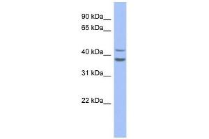 SERPINB2 antibody used at 1 ug/ml to detect target protein. (SERPINB2 anticorps)