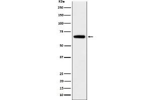 Western blot analysis of IGF2BP2 expression in 293T cell lysate.