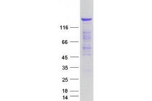 Validation with Western Blot