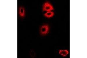 Immunofluorescent analysis of HADHA staining in U2OS cells. (HADHA anticorps)