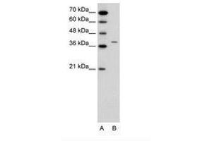 Image no. 1 for anti-Receptor-Associated Protein of The Synapse (RAPSN) (N-Term) antibody (ABIN6736649)