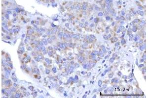 IHC analysis of C18orf22/RBFA using anti-C18orf22/RBFA antibody (ABIN7600106). (RBFA anticorps  (AA 15-319))
