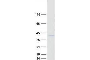 Validation with Western Blot