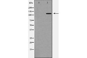Western blot analysis of TYK2 expression in 293 cell,The lane on the left is treated with the antigen-specific peptide. (TYK2 anticorps  (C-Term))