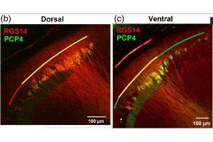 Representative images of RGS14 and PCP4 immunofluorescence.