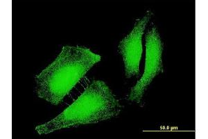 Immunofluorescence of monoclonal antibody to FOXO3 on HeLa cell. (FOXO3 anticorps  (AA 361-460))