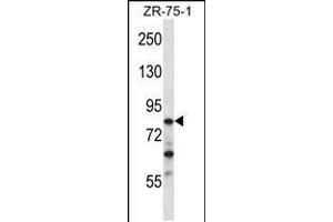 Western blot analysis in ZR-75-1 cell line lysates (35ug/lane). (CNOT3 anticorps  (N-Term))