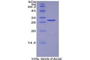 SDS-PAGE analysis of Human TOR1AIP2 Protein. (TOR1AIP2 Protéine)