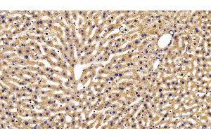 Detection of DBI in Mouse Liver Tissue using Polyclonal Antibody to Diazepam Binding Inhibitor (DBI)