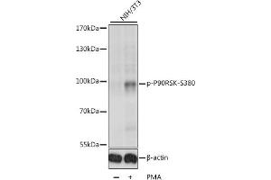 Western blot analysis of extracts of various cell lines, using Phospho-p90Rsk/RSK1/RPS6K-S380 antibody (ABIN6135275, ABIN6136172, ABIN6136173 and ABIN6225586) at 1:1000 dilution.
