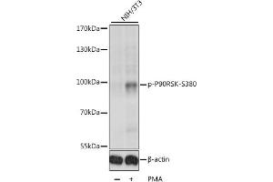 Western blot analysis of extracts of various cell lines, using Phospho-p90Rsk/RSK1/RPS6K-S380 antibody (ABIN6135275, ABIN6136172, ABIN6136173 and ABIN6225586) at 1:1000 dilution. (RPS6KA1 anticorps  (pSer380))