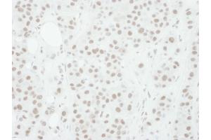 Immunohistochemistry (IHC) image for anti-Mitogen-Activated Protein Kinase Kinase 1 (MAP2K1) (pThr286) antibody (ABIN7454494)