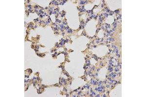 Immunohistochemistry (IHC) image for anti-Protein Kinase, CAMP Dependent, Catalytic, beta (PRKACB) antibody (ABIN1876512) (PRKACB anticorps)