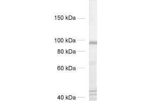dilution: 1 : 500, sample: rat brain homogenate (CASK anticorps  (AA 1-337, AA 318-415))