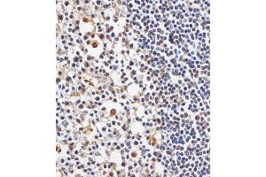 (ABIN6244013 and ABIN6578740) staining TAF4 in human tonsil tissue sections by Immunohistochemistry (IHC-P - paraformaldehyde-fixed, paraffin-embedded sections). (TAF4 anticorps  (AA 1021-1062))