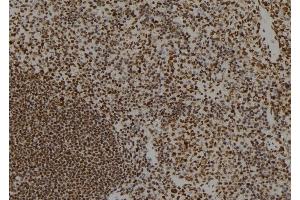 ABIN6264378 and ABIN6279693 at 1/100 staining Mouse spleen tissue by IHC-P.